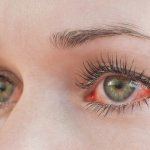 Đôi mắt là cửa sổ tâm hồn và cũng là bộ phận quan trọng trên cơ thể. Mọi hoạt động của chúng ta đều cần đôi mắt. Đôi khi, vì một vài nguyên nhân nào đó khiến mắt bạn bị mỏi và đỏ lên. Bài viết dưới đây sẽ lý giải tại sao mắt đỏ, cách khắc phục và phòng tránh cho đôi mắt sáng khỏe. Mời bạn cùng đón đọc nhé!