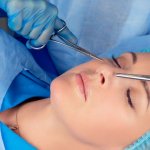 Lakukan Nose Reshaping di Banjarmasin dan Perawatan Lainnya di 6 Rekomendasi Klinik Ini! (2023)