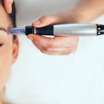 Anda tinggal di Surabaya dan sedang mencari klinik microneedling terbaik? Pastikan Anda membaca artikel BP-Guide ini sampai habis untuk menemukan rekomendasi terbaiknya ya!