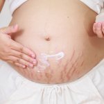 Anda tidak perlu lagi khawatir tentang stretch mark yang mengganggu penampilan kulit Anda. Temukan solusi yang efektif dan mudah dengan penghilang stretch mark terbaik di pasaran. Bahan-bahan berkualitas dan formula unik membantu merawat kulit Anda dari dalam, membantu mengurangi stretch mark, dan mengembalikan kelembutan serta kekencangan kulit Anda.