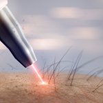 Apakah Anda sedang mencari klinik hair removal di Semarang? Nah, BP-Guide akan membagikan tips mencari klinik hair removal untuk Anda. Selain itu, juga akan memberikan rekomendasi klinik hair removal di Semarang.