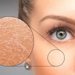 Artikel ini memperkenalkan kamu kepada salah satu kondisi kulit, yaitu kulit kering. Selain mengetahui ciri-cirinya, dengan artikel ini diharapkan kamu juga mendapatkan beberapa tips untuk mengatasi permasalahan kulit kering. Tak hanya itu, artikel ini juga memberikan rekomendasi 10 jenis pelembap wajah untuk kulit kering yang bisa kamu coba.