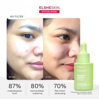 ElsheSkin Radiant Supple Serum