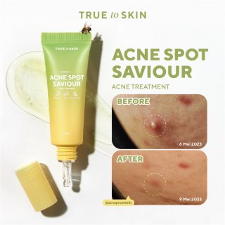 True to Skin - Acne Spot Saviour