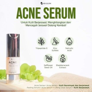 Mas Glow Serum Khusus Kulit Sensitif Berjerawat Ori