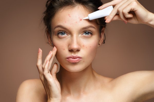 15 Rekomendasi Skincare untuk Menghilangkan Bekas Jerawat (2023)