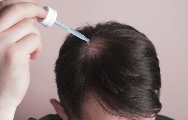 Kembalikan Rasa Percaya Diri dengan 15 Rekomendasi Serum Penumbuh Rambut yang Ampuh Mengatasi Kerontokan Rambut (2023)