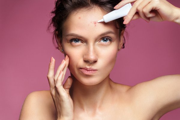 Troubled by Acne? Here are the 10  Best Face Creams for Acne Prone Skin That Keep Your Skin Hydrated While Driving Away Acne (2019)!