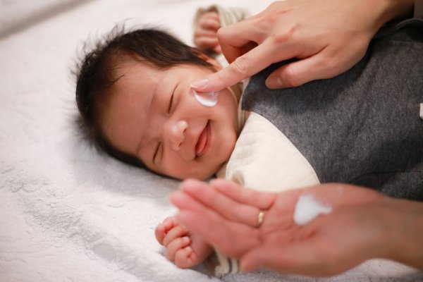 10 Rekomendasi Produk yang Bisa Atasi Biang Keringat Bayi dengan Efektif (2021)