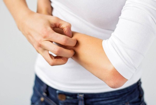 Stung by Pesky Bugs? Get Quick Relief Using These Top Home Remedies for Insect Bites To Reduce the Pain and the Swelling (2021)